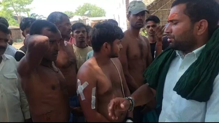 खीरी के ईसानगर में आदमखोर तेंदुए का हमला, पांच किसान घायल, गांव में दहशत